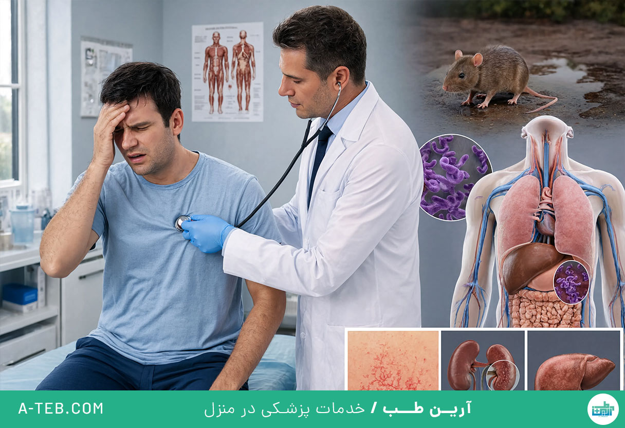 لپتوسپیروز