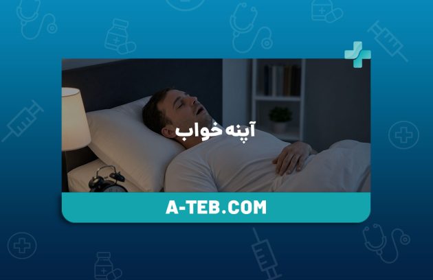 آپنه خواب