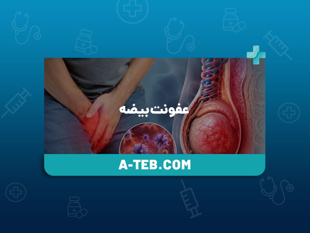 عفونت بیضه