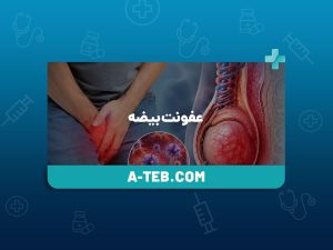 عفونت بیضه