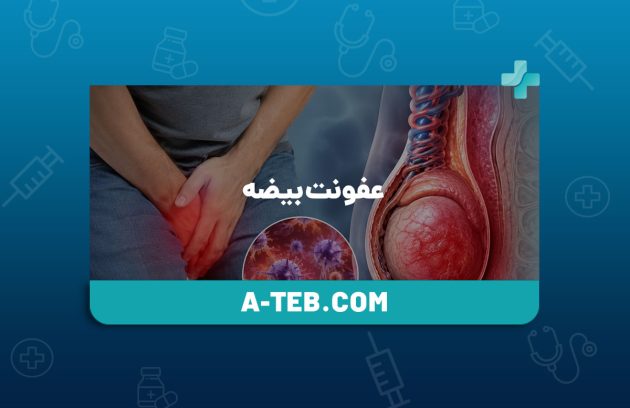 عفونت بیضه