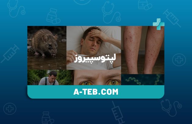 لپتوسپیروز