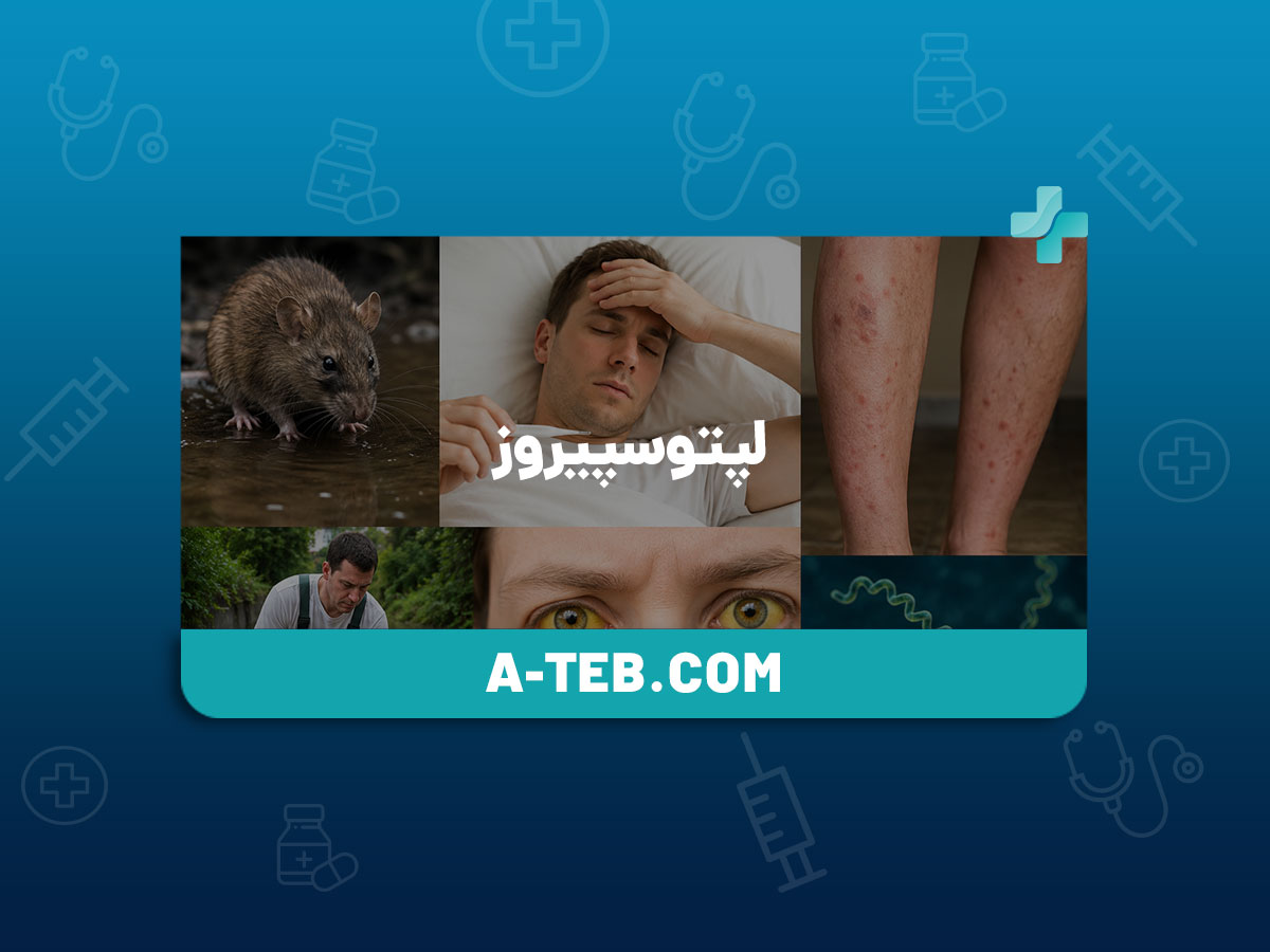 لپتوسپیروز