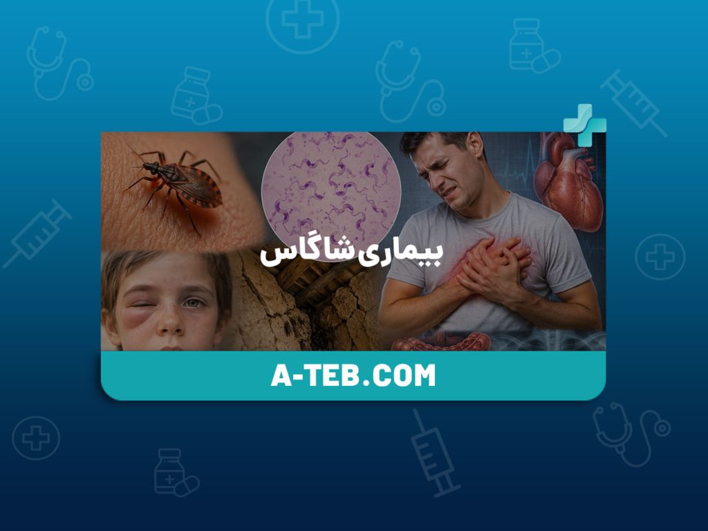 بیماری شاگاس
