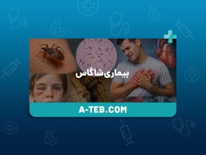 بیماری شاگاس