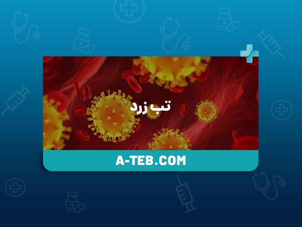 تب زرد