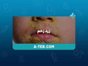 زرد زخم