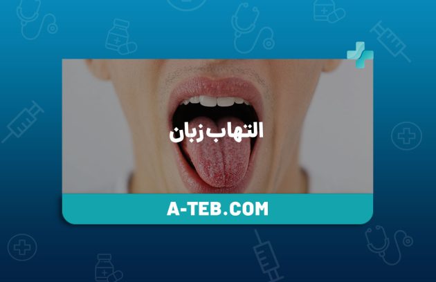 التهاب زبان