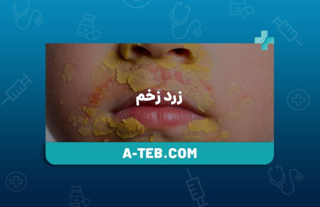 زرد زخم