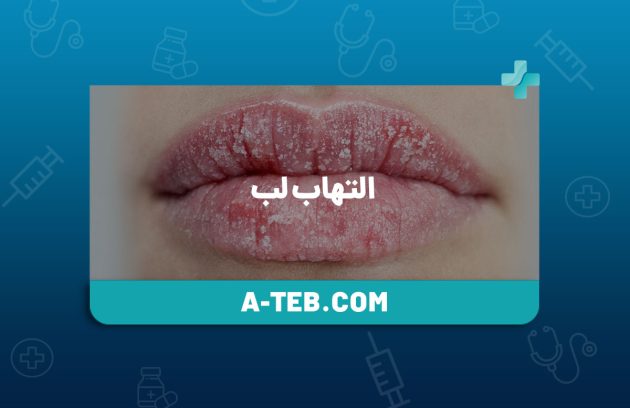 التهاب لب