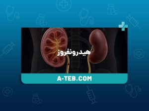 هیدرونفروز