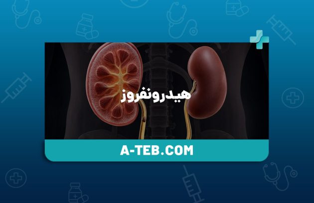هیدرونفروز