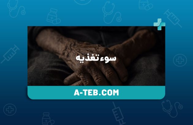 سوء تغذیه