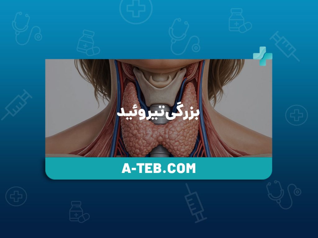 بزرگی تیروئید