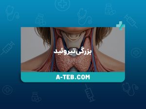 بزرگی تیروئید
