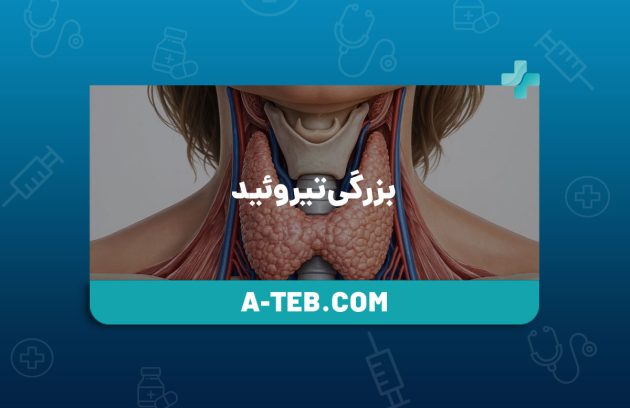 بزرگی تیروئید