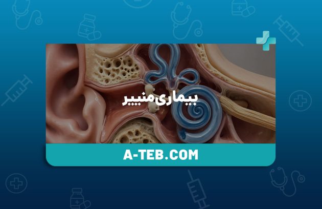 بیماری منییر