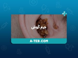 جرم گوش