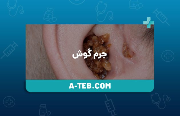 جرم گوش