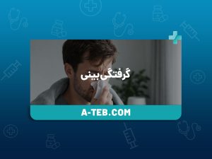 گرفتگی بینی