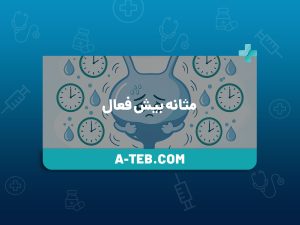 مثانه بیش فعال