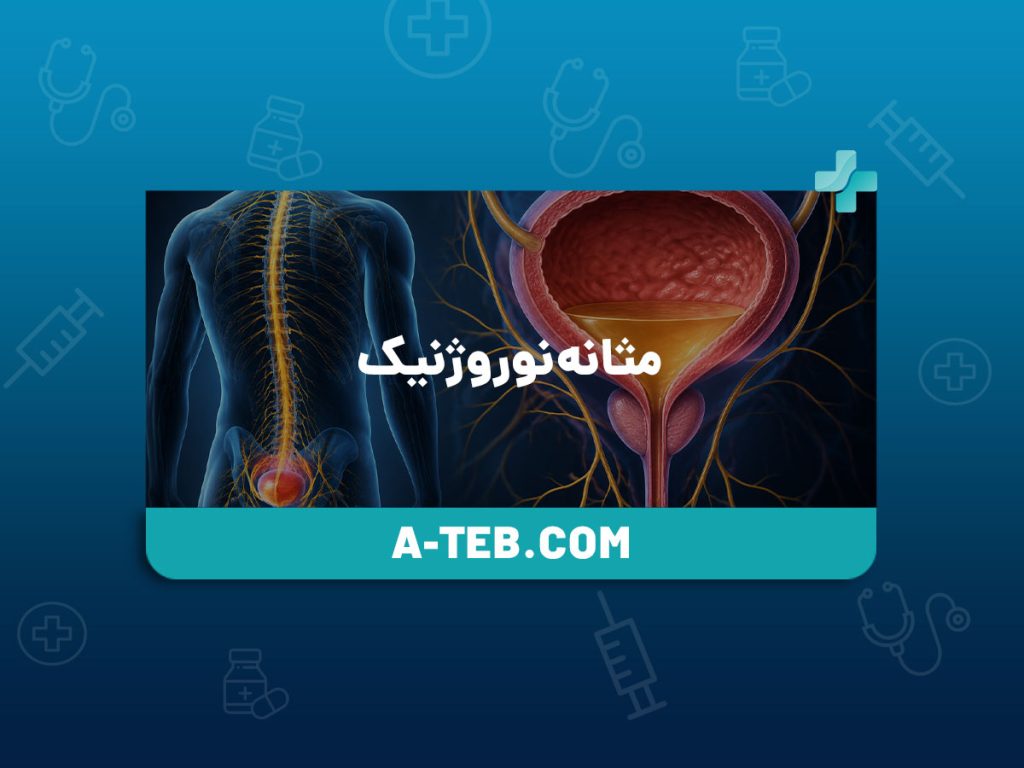 مثانه نوروژنیک