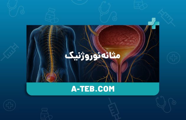 مثانه نوروژنیک