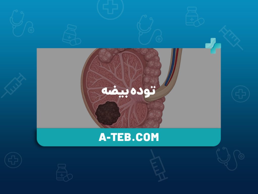 توده بیضه