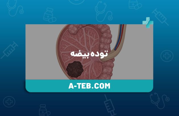توده بیضه