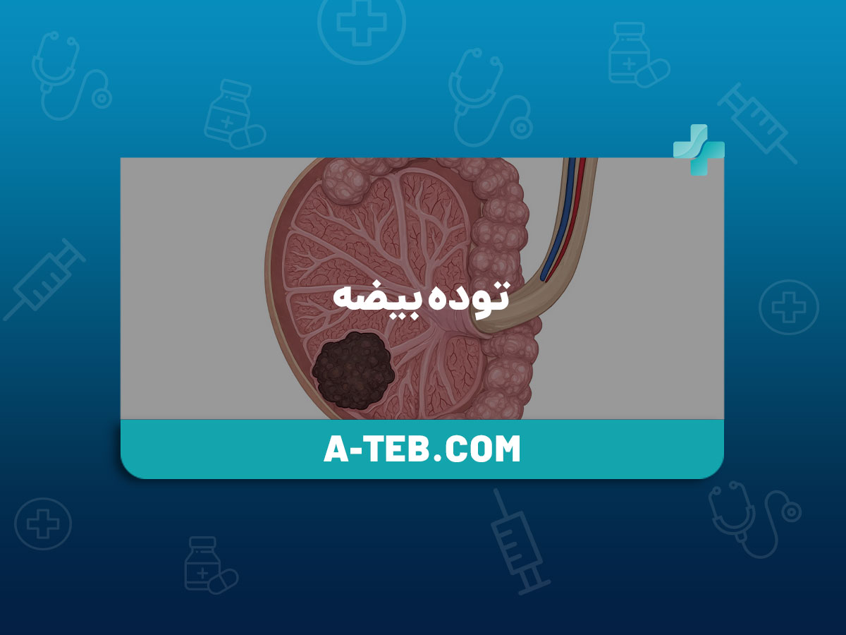 توده بیضه