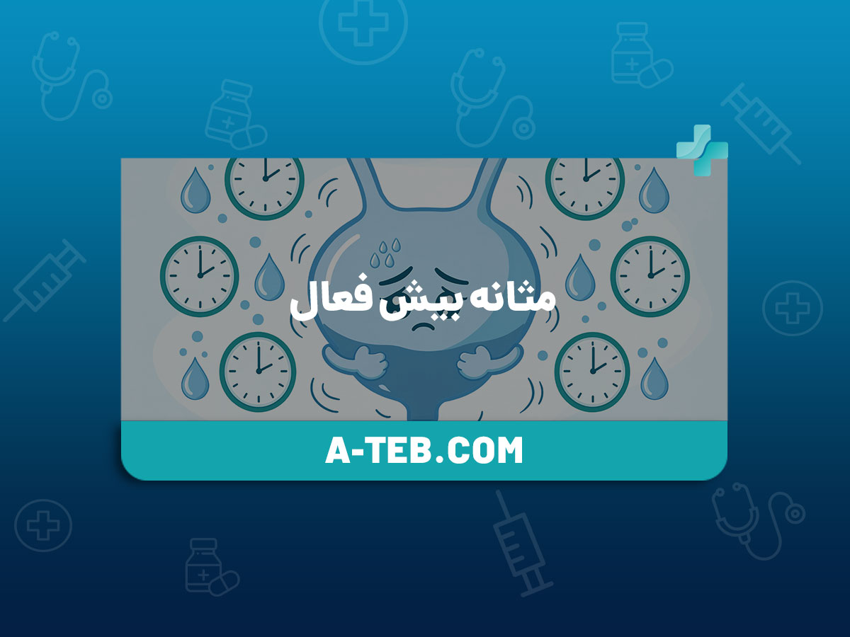 مثانه بیش فعال