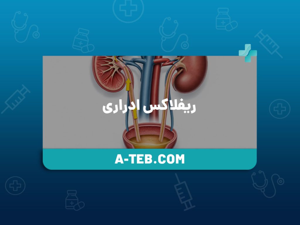 ریفلاکس ادراری