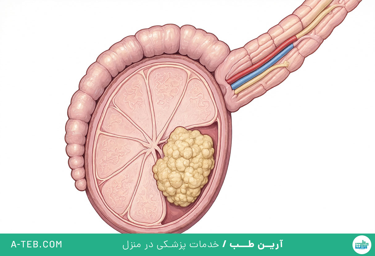 توده بیضه