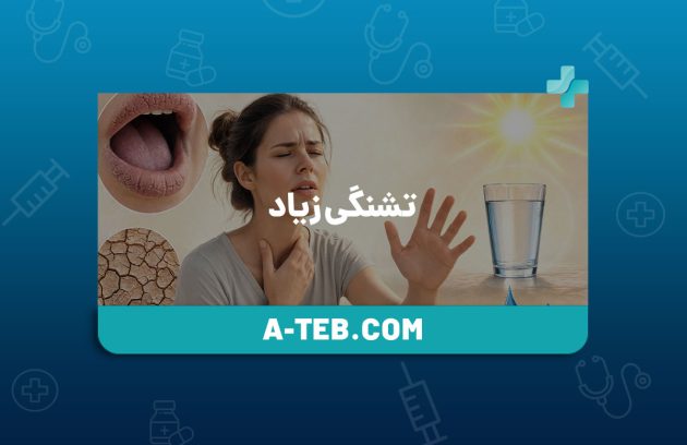 تشنگی زیاد