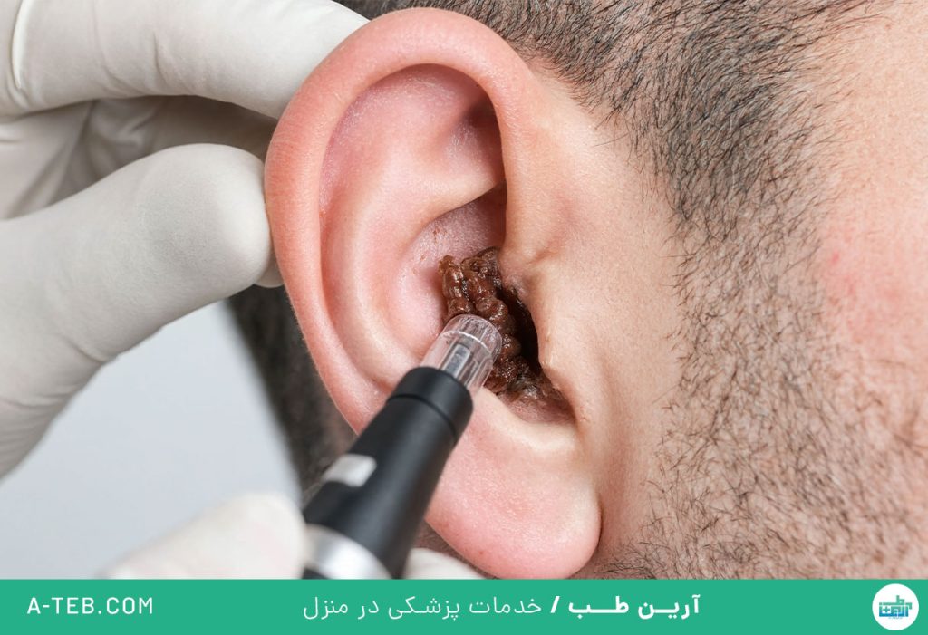 جرم گوش