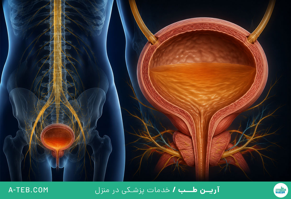 مثانه نوروژنیک
