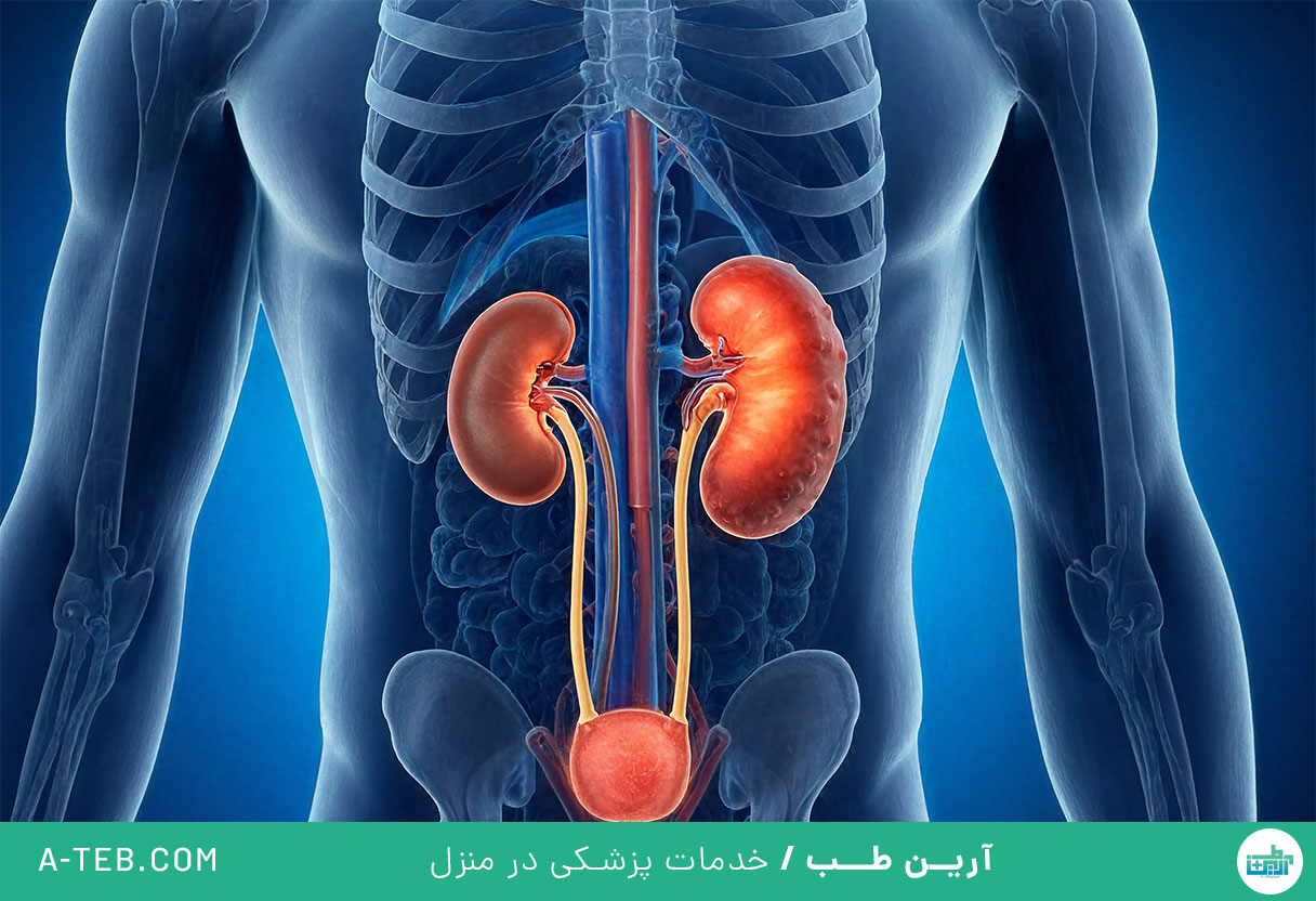 هیدرونفروز