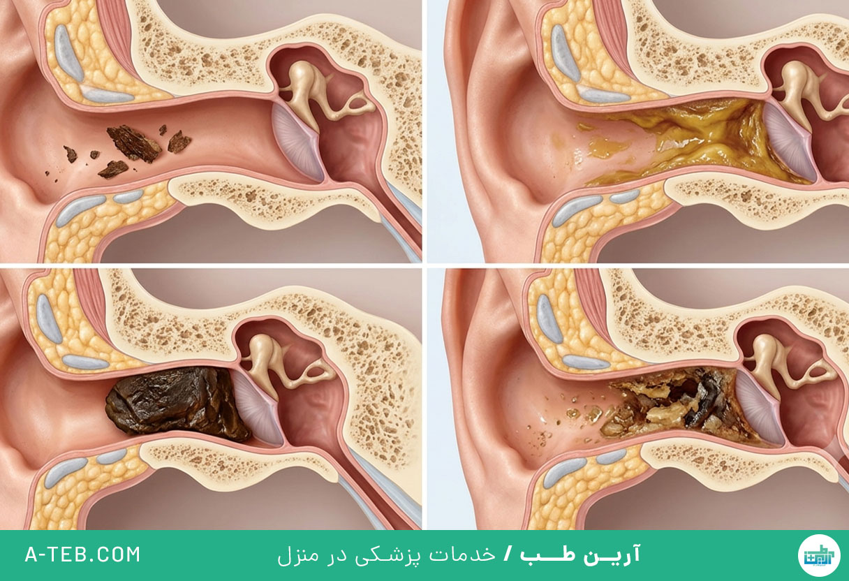 جرم گوش