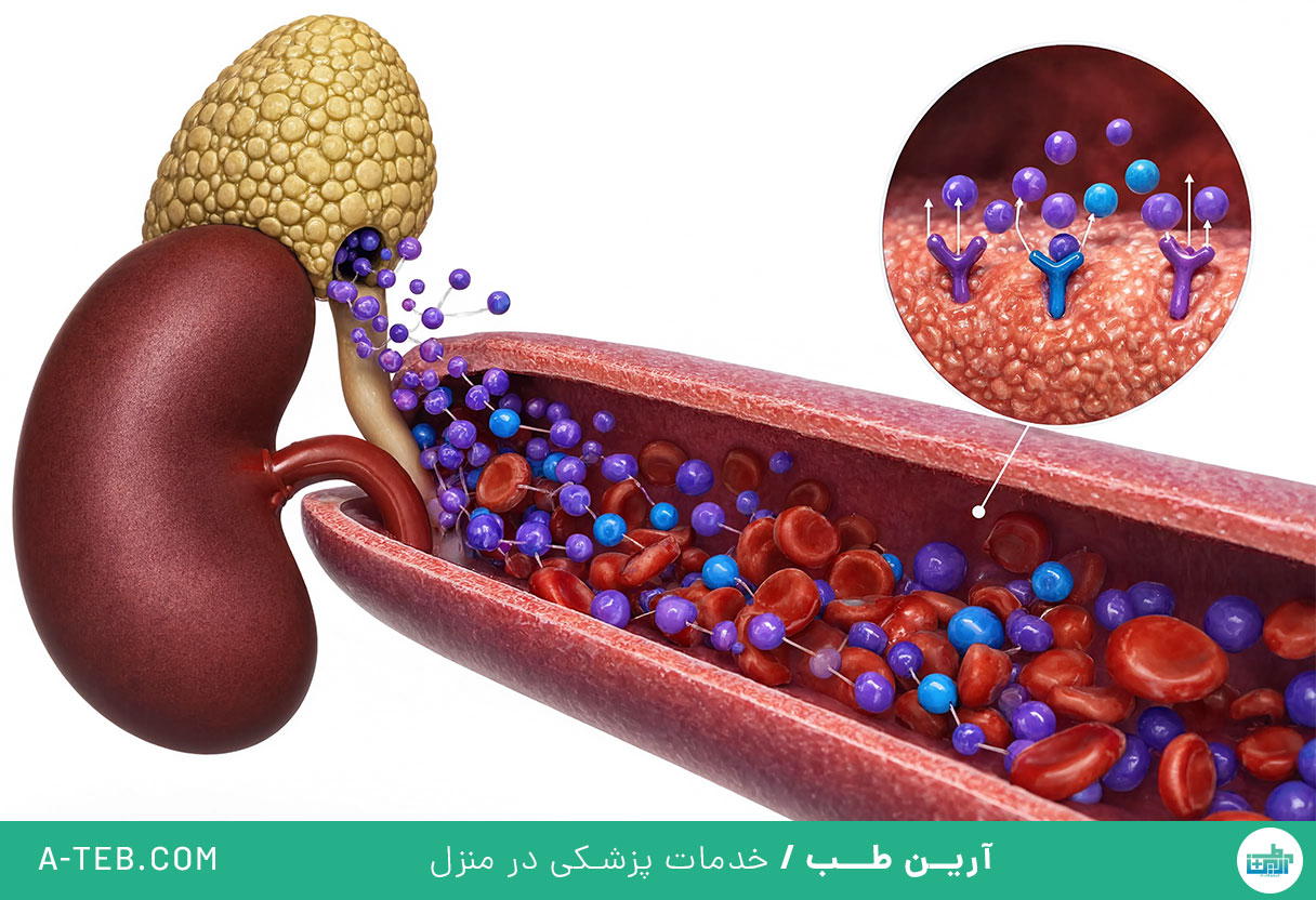 فئوکروموسیتوما