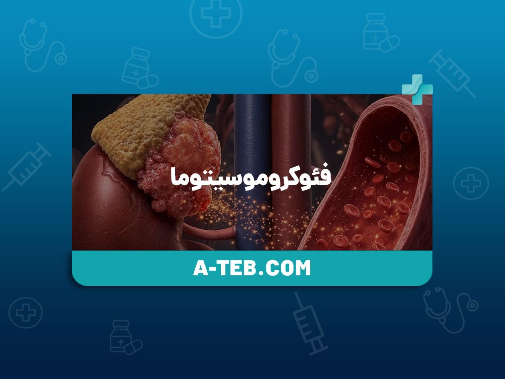 فئوکروموسیتوما
