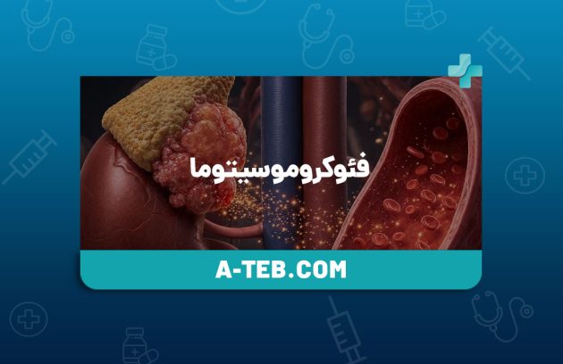 فئوکروموسیتوما