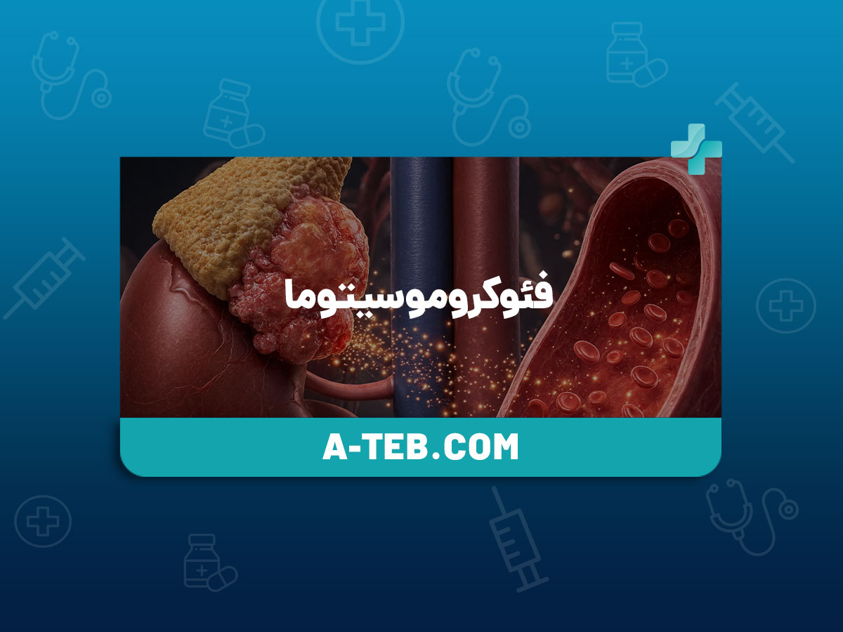 فئوکروموسیتوما