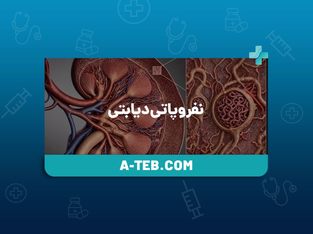 نفروپاتی دیابتی