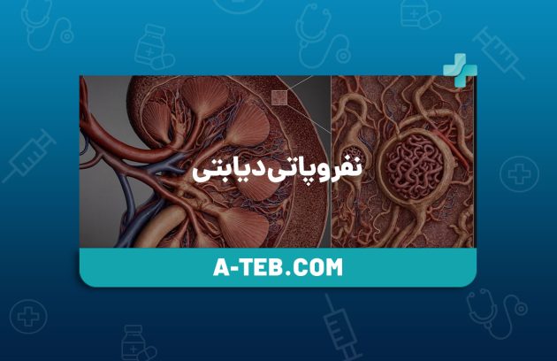 نفروپاتی دیابتی