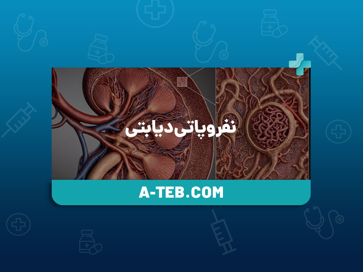 نفروپاتی دیابتی