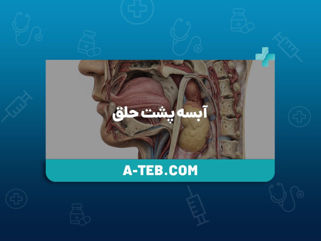 آبسه پشت حلق