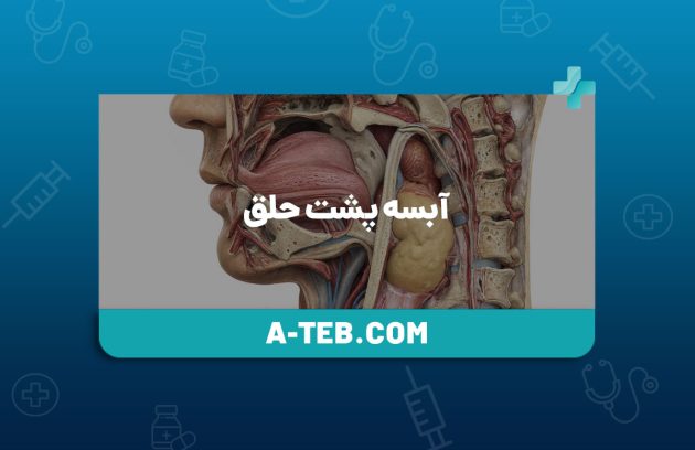 آبسه پشت حلق