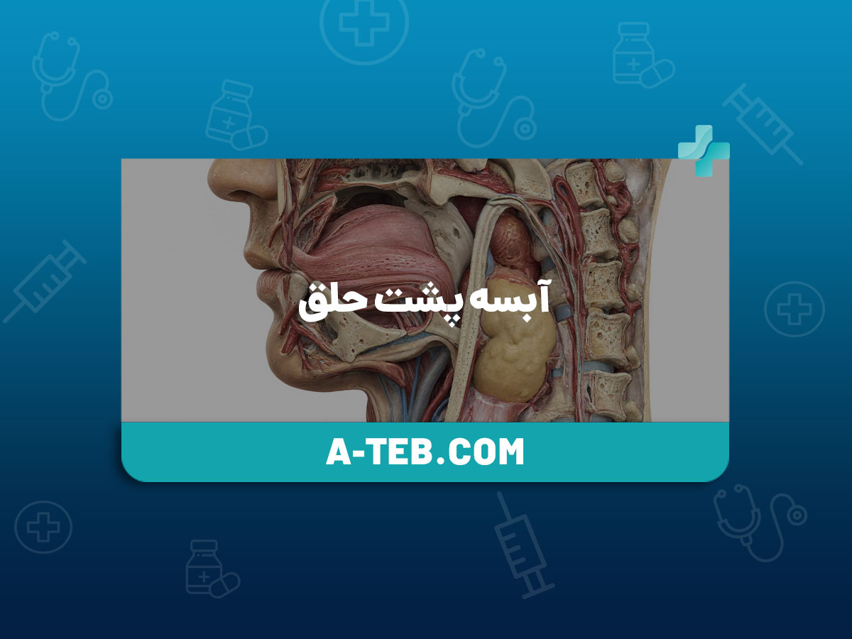 آبسه پشت حلق