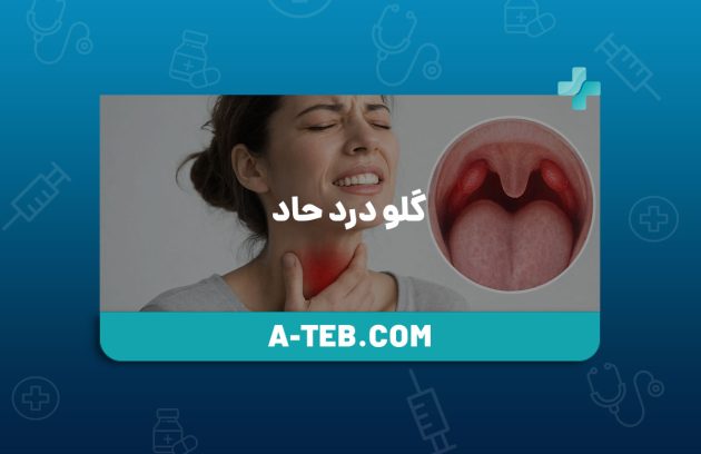 گلو درد حاد