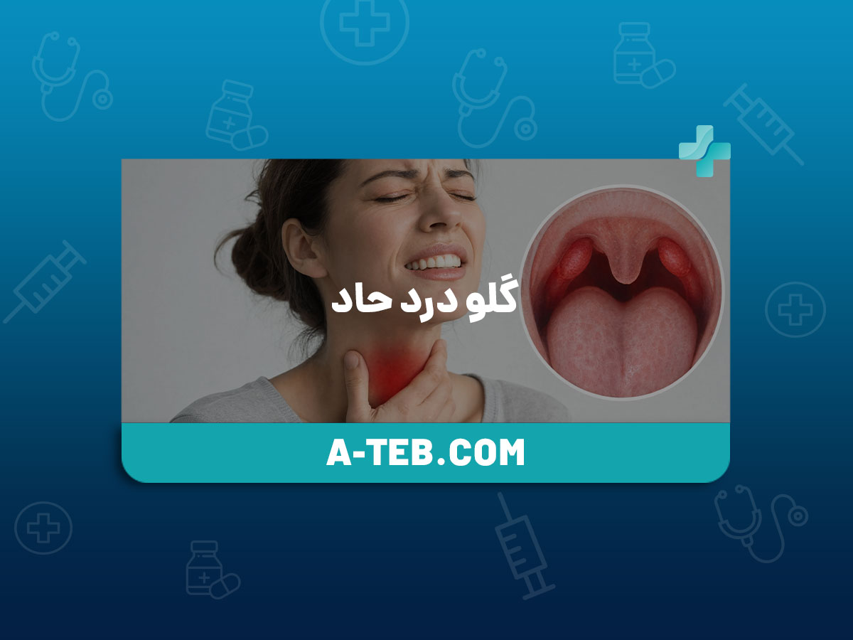 گلو درد حاد